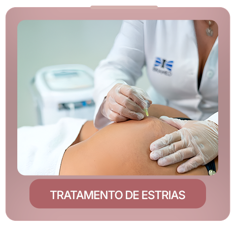 tratamento de estrias