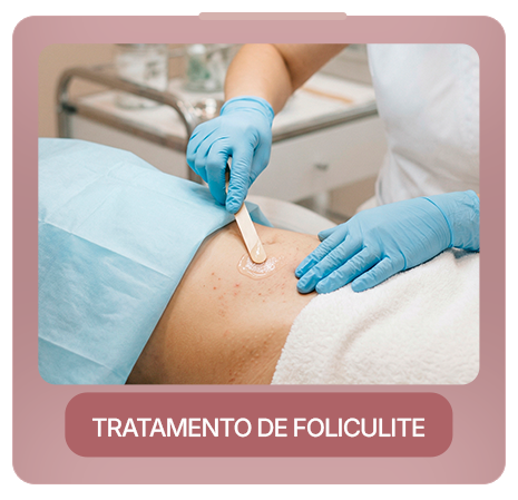 tratamento de foliculite